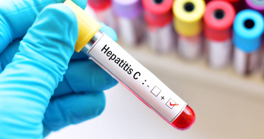 Everything You Should Know About Hepatitis C